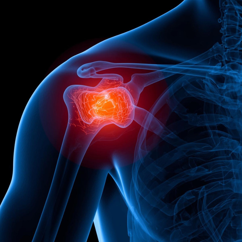 shoulder pain treatment