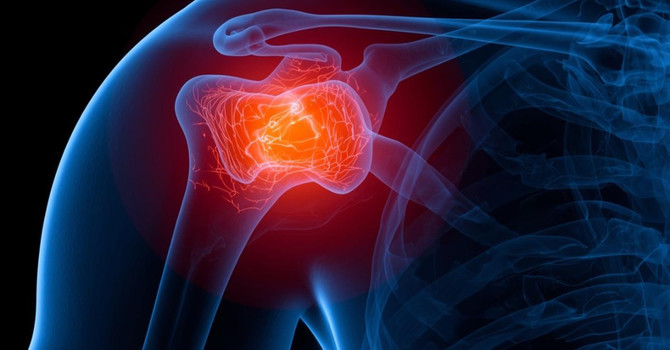Shoulder Pain Treatment